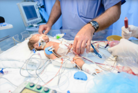 Pediatric Cardiac Surgery