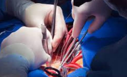 Cardiac Surgery